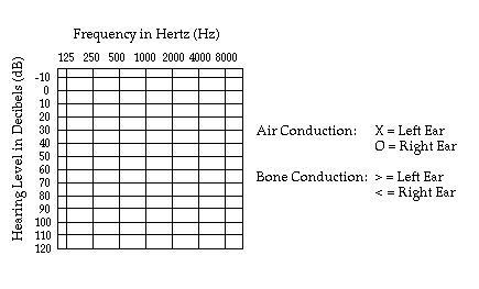 Blank Audiogram Chart